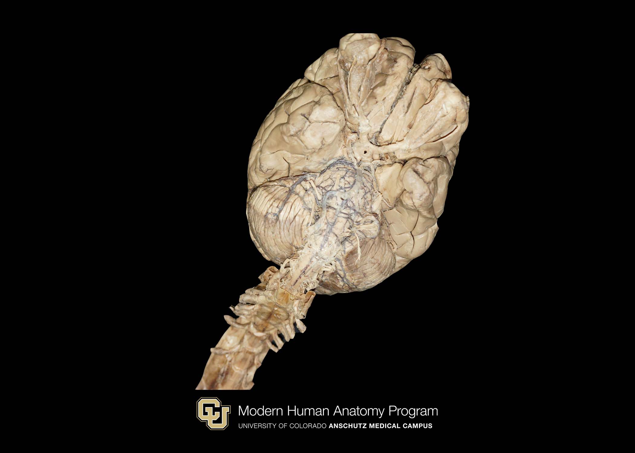 CU Plastinated Organ Library